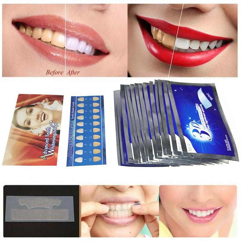 Tiras de Gel para Clareamento Dental Heonyirry - 14 pares